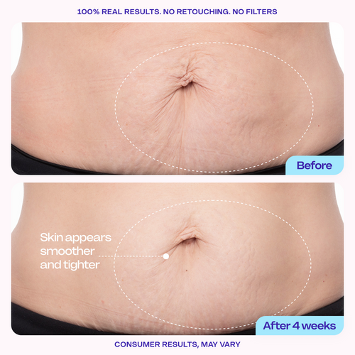 Tighten & Smooth Belly Cream