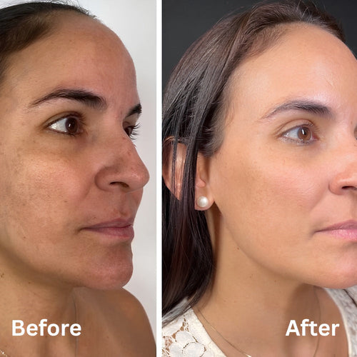 Beauty Peel Shot - White + Black Rice Set