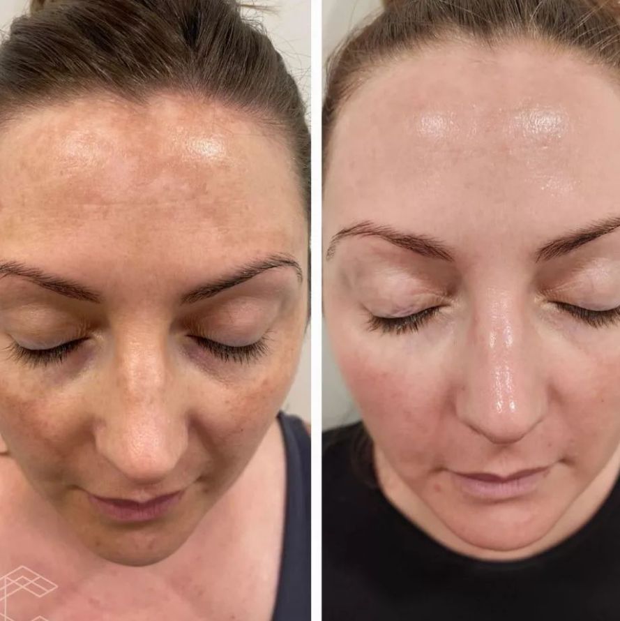 Targeted Dark Spot Care, Without the Guesswork