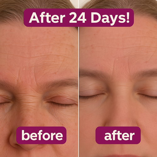 Anti Wrinkle Calcium Balm