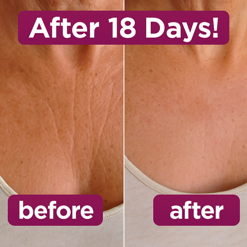 Anti Wrinkle Calcium Balm